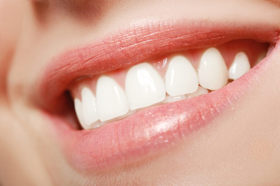 Cosmetic Dentistry